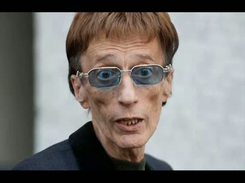 Robin Gibb of the Bee Gees Hospitalized for Intestinal Surgery