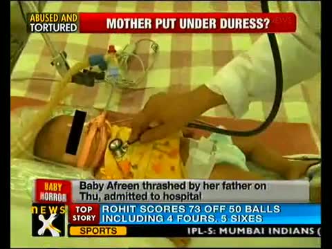 Battered baby Aafreen on life support system