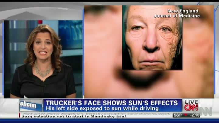 Trucker Says Sun Did THIS To His Face