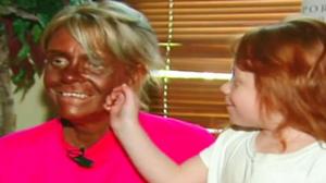 Jersey Woman Arrested For Tanning Daughter