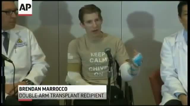 Double-Arm Transplant Recipient: Feels Amazing