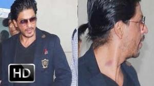 OMG! Is That A Love Bite On Shahrukh Khan's Neck?! (See Now)