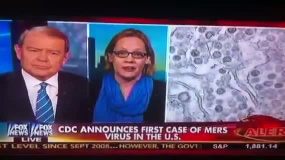 1st CASE OF MERS VIRUS IN USA! REPENT AMERICA CAN'T YOU SEE GODS JUDGEMENT UPON YOU!!!