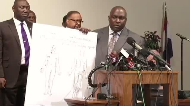 Independent Autopsy Reveals Michael Brown Wounds