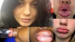 Kylie Jenner Lip Challenge WTF