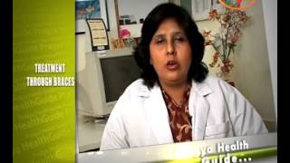 Treatment Through Braces - Types & Treatment By Dr. Umang Nayar (Dental Surgeon)