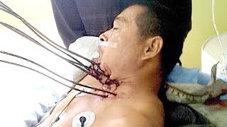 Man Suffers Worst Accident Ever - Unbelievable Story