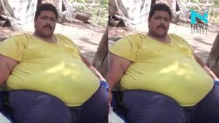 World's most obese man dies after surgery in Mexico