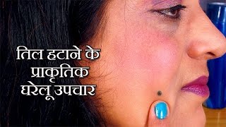 Beauty Mark Removal Tips in Hindi