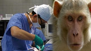 Monkey head transplant done first time in history, surgeon claims successful