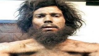 SHOCKING Photo of Randeep Hooda that will Blow your MIND | MUST WATCH