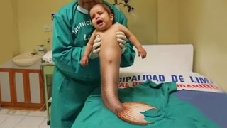 TOP 10 STRANGEST REAL BABIES IN THE WORLD