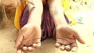 Rajasthan man inscribes tattoo abuses on wife's body