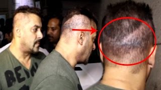 Salman Khan Hair Transplant Went Wrong?