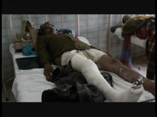 लुटेरों को पकड़ने में टूटा होमगॉर्ड का पैर, पुलिस ने मानने से किया इंकार