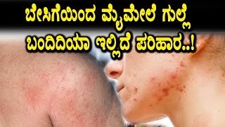Are you facing summer skin problems | Home remedy | Top Kannada Health Tips