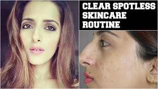 #Beauty Tips For Face- How To Get Crystal Clear, Glowing, Spotless Skin / Remove Acne & Pimple Scars