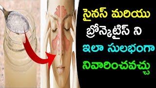 Treat Sinus Infections and Bronchitis with One Little Trick  Natural Cure for Sinus & Bronchitis