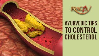 Ayurvedic Tips To Control Your Cholesterol - Dr. Vibha Sharma (Ayurveda & Panchkarma Expert)