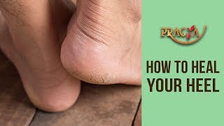 How To Heal Your Heel- Dr. Vibha Sharma (Ayurveda & Panchkarma Expert)