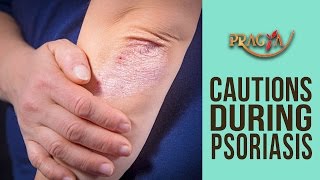 Cautions During Psoriasis | Dr. Dhruv (Dermatologist)