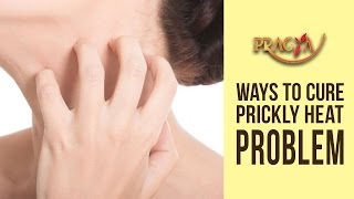 Ways To Cure Prickly Heat Problem | Dr. Shehla Aggarwal (Dermatologist)