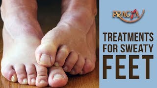 Treatments For Sweaty Feet | Dr. Shehla Aggarwal (Dermatologist)