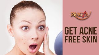 Get Acne Free Skin | Payal Sinha (Naturopath Expert)