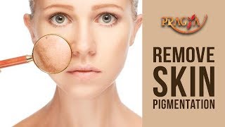 How To Remove Skin Pigmentation Tips | Dr. D.M. Mahajan (Dermatologist)