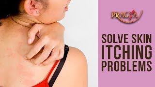 How To Get Rid Of Skin Itching Problems Dr. Vibha Sharma (Ayurveda Consultant)