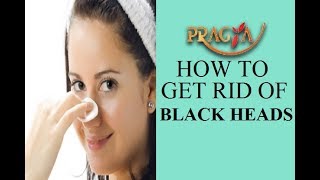 How To Get Rid Of Black Heads Dr. Shehla Aggarwal (Dermatologist)