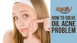 How To Solve Oil Acne Problem | Dr. D.M. Mahajan (Dermatologist)