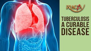 TUBERCULOSIS A Curable Disease | Dr. Rajal Jhamb (Consultant Physician)