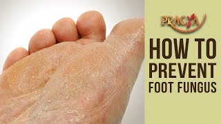SKIN PROBLEM | How To Prevent Foot Fungus | Dr. Shehla Agarwal