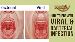 How To Prevent Viral & Bacterial Infection | Dr. Shehla Aggarwal (Dermatologist)