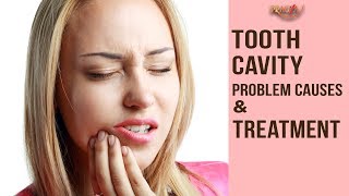 Tooth Cavity- Problem, Causes & Treatment | Dr. Arunima Singhal