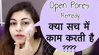 How to get rid of Large Pores Permanently - Young tighten skin | Open Pores Treatment | JSuper Kaur