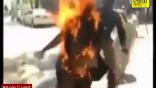 मोबाइल से जला आदमी || मोबाइल गर्म हो तो सावधान || Sidhi Nazar
