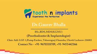 Tooth & Implants Dental ClinicExperience the Perfection || Dr.Gaurav Bhalla || KKD NEWS