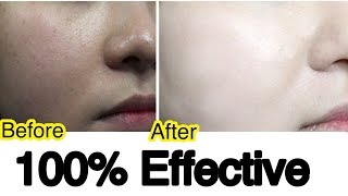 Skin Whitening Serum For Glowing Milky White Skin | Summer Skin Care | JSuper Kaur