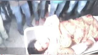 Shopian Grenade Attack:Many People Injured Including Police Personnel's.