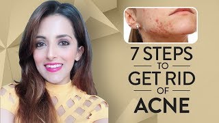 7 Steps TO GET CLEAR ACNE FREE SKIN/ How To Get Rid Of Pimples & Get CLEAR, GLOWING SKIN + GIVEAWAY