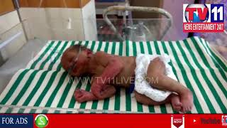 NEW BORN BABY FOUND IN BARBED PLACE IN BAGA REDDY COLONY , ZAHIRABAD | Tv11 News | 30-04-2018