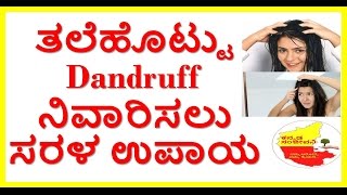 how to remove dandruff naturally. 8 best home remedies for dandraff control..kannada sanjeevani.