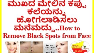 how to remove dark spots from face..how to reduce black spots on face.