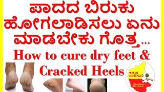 How to cure dry feet & cracked heels at home..Kannada Sanjeevani..