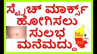 How to Remove Stretch Marks fast..Kannada Sanjeevani