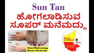 How to remove Sun Tan very fast in kannada | Skin Whitening facepack | Kannada Sanjeevani