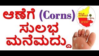 Home Remedies for Corns in Kannada | Kannada Sanjeevani