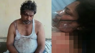Husband Burns Wife With Kerosene In Hyderabad Golconda | @ SACH NEWS |